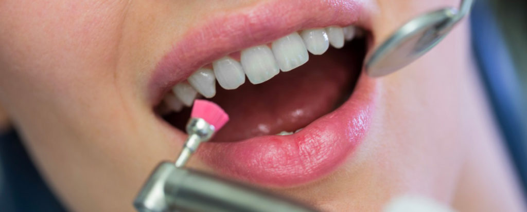 Studio Schweiger - Dentista a Pieve di Cadore - Studio Schweiger dentista a Pieve di Cadore | Igiene