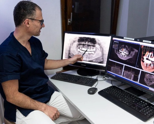 Studio Schweiger dentista a Pieve di Cadore | Implantologia