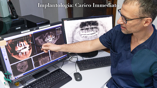 Vuoi eliminare i fastidi derivati dalla mancanza di denti? Leggi l'articolo completo per scoprire di più sugli impianti dentali a carico immediato!