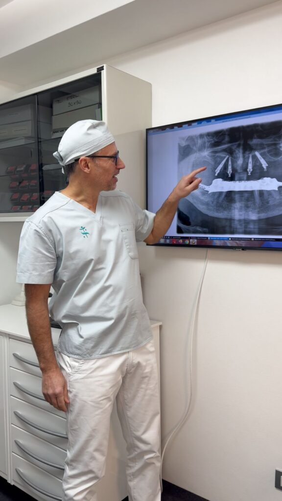 Quanto dura un impianto dentale