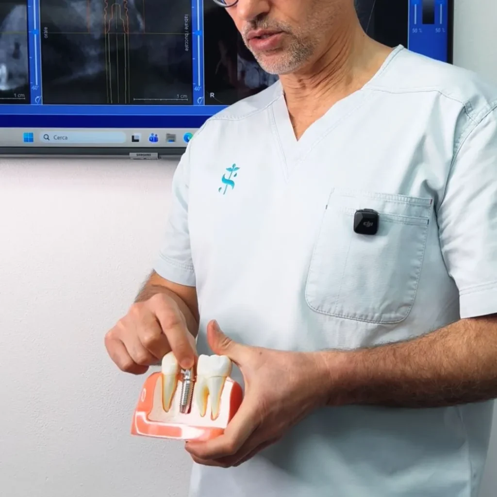 Studio Schweiger - Dentista a Pieve di Cadore - Come capire se l’impianto dentale si sta muovendo